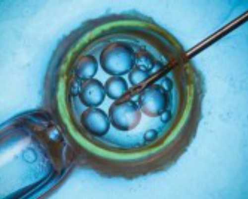 代妈九院精子库供精试管费用解析及取卵方式对比