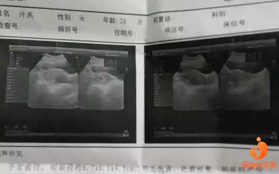北京代孕可以选择性别吗-代孕中介哪里找_【北京哪家医院供卵】40+6周剖腹产